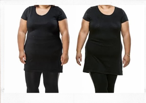 Why choose weight loss treatments in Miami Lakes Medical Center