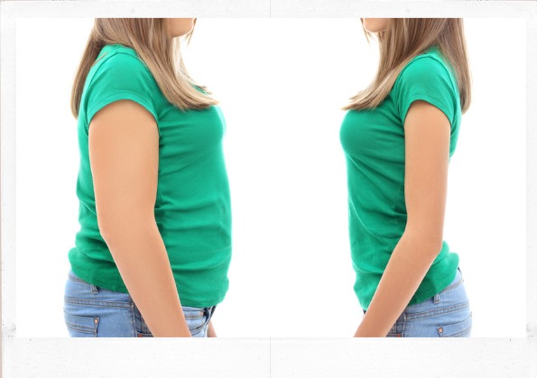 before and after weight loss treatments with Semaglutide