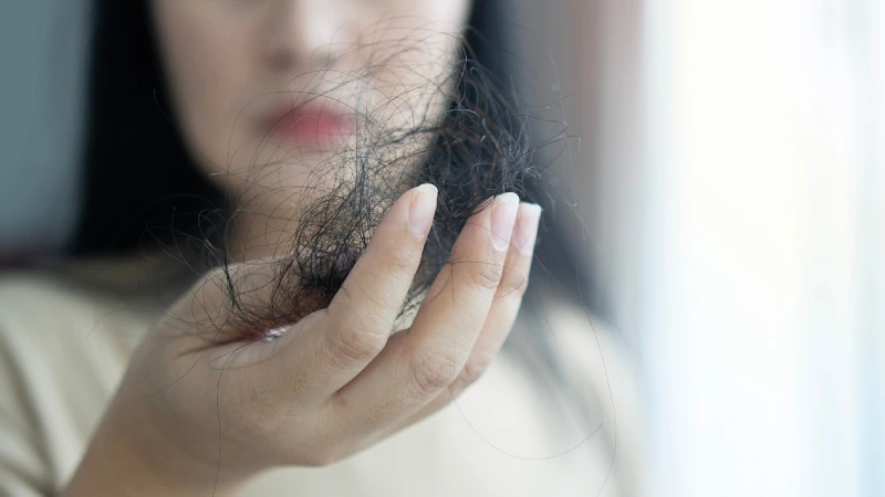 ¿Por qué se produce la caída del cabello?